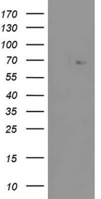 Western Blot: ZNF286 Antibody (OTI7D2)Azide and BSA Free [NBP2-74935]