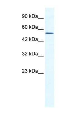 Western Blot: ZNF286 Antibody [NBP1-80119]