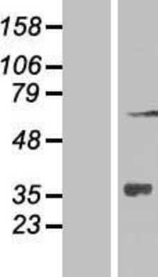 Western Blot: ZNF286 Overexpression Lysate [NBP2-06607]