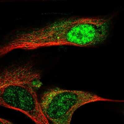 Immunocytochemistry/ Immunofluorescence: ZNF286B Antibody [NBP2-38115]