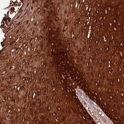 Immunohistochemistry-Paraffin: ZNF286B Antibody [NBP2-38115]