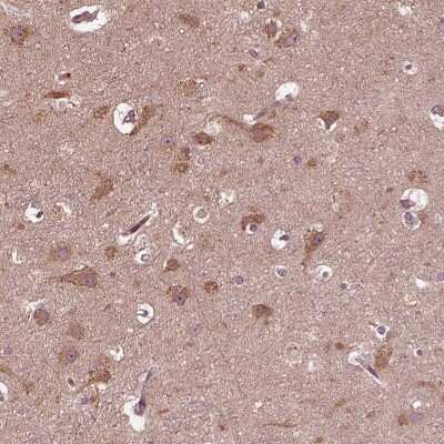 Immunohistochemistry-Paraffin: ZNF292 Antibody [NBP2-55356]