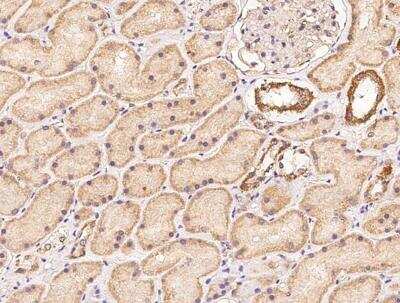 Immunohistochemistry-Paraffin: ZNF292 Antibody [NBP3-12714]