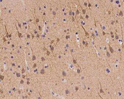 Immunohistochemistry-Paraffin: ZNF292 Antibody [NBP3-12714]