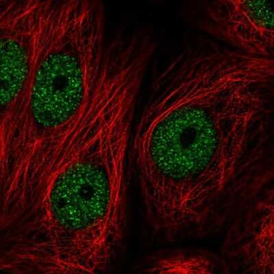 Immunocytochemistry/ Immunofluorescence: ZNF295 Antibody [NBP2-55456]