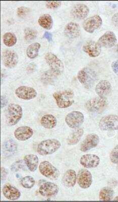 Immunohistochemistry: ZNF295 Antibody [NB100-74655]