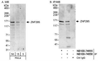 Western Blot: ZNF295 Antibody [NB100-74656]