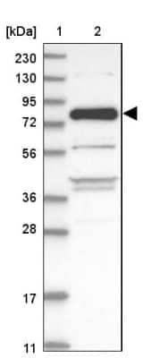 Western Blot: ZNF295 Antibody [NBP1-82923]