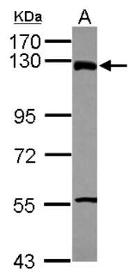 Western Blot: ZNF295 Antibody [NBP2-20986]