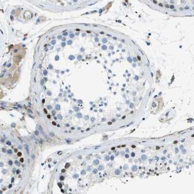 Immunohistochemistry-Paraffin: ZNF297B Antibody [NBP1-92621]