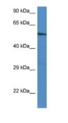 Western Blot: ZNF297B Antibody [NBP1-91622]