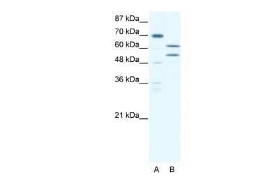 Western Blot: ZNF297B Antibody [NBP2-88661]