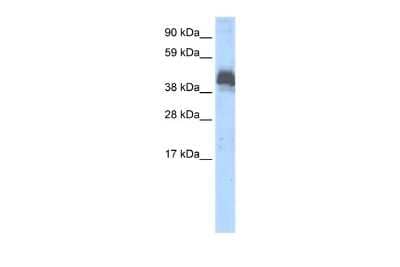 Western Blot: ZNF297B Antibody [NBP2-88662]