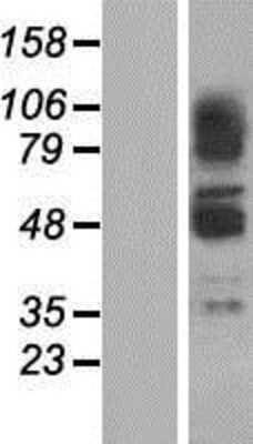 Western Blot: ZNF297B Overexpression Lysate [NBP2-07393]