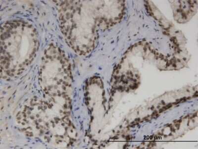 Immunohistochemistry-Paraffin: ZNF3 Antibody (1F7) [H00007551-M08]