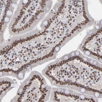 Immunohistochemistry-Paraffin: ZNF3 Antibody [NBP1-89329]
