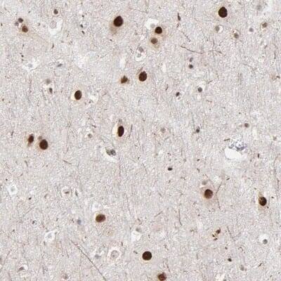 Immunohistochemistry-Paraffin: ZNF3 Antibody [NBP1-89329]