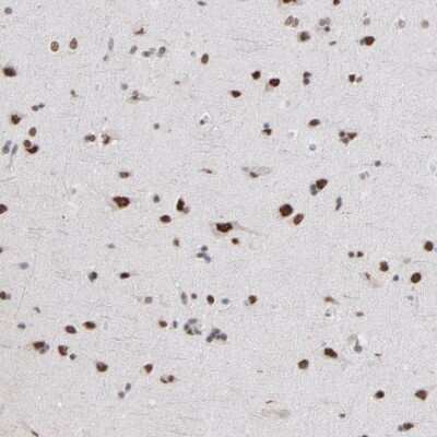 Immunohistochemistry-Paraffin: ZNF3 Antibody [NBP1-89329]