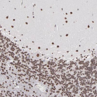 Immunohistochemistry-Paraffin: ZNF3 Antibody [NBP1-89329]
