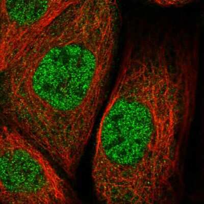 Immunocytochemistry/ Immunofluorescence: ZNF30 Antibody [NBP1-84108]