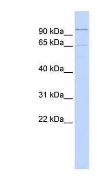 Western Blot: ZNF30 Antibody [NBP1-80199]