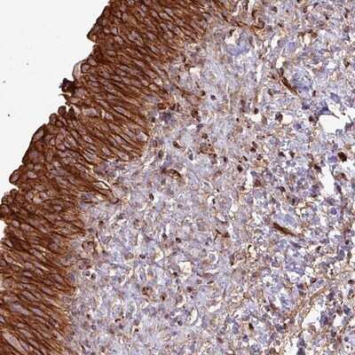 Immunohistochemistry-Paraffin: ZNF300 Antibody [NBP2-13566]
