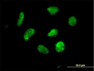 Immunocytochemistry/ Immunofluorescence: ZNF302 Antibody [H00055900-B01P]