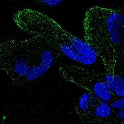 Immunocytochemistry/ Immunofluorescence: ZNF302 Antibody [NBP2-56936]