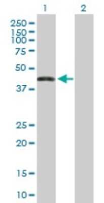 Western Blot: ZNF302 Antibody [H00055900-B01P]