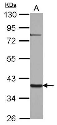 Western Blot: ZNF302 Antibody [NBP2-15170]