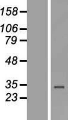 Western Blot: ZNF302 Overexpression Lysate [NBL1-18113]