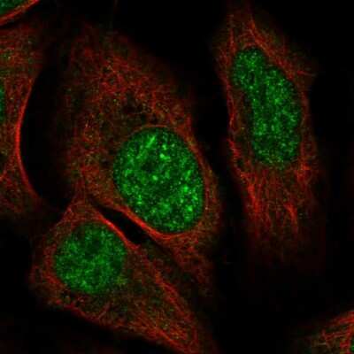 Immunocytochemistry/ Immunofluorescence: ZNF304 Antibody [NBP2-31901]