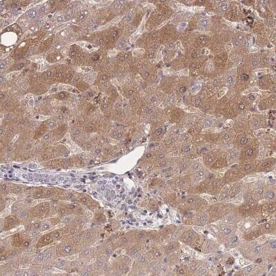 Immunohistochemistry-Paraffin: ZNF304 Antibody [NBP2-31901]