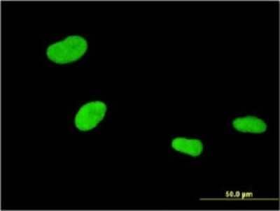 Immunocytochemistry/ Immunofluorescence: ZNF307 Antibody (1D2) [H00387032-M01]