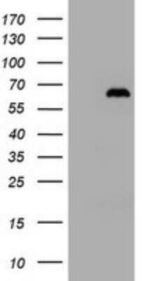 Immunohistochemistry: ZNF307 Antibody (OTI6G6) - Azide and BSA Free [NBP2-74936]