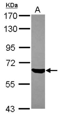 Western Blot: ZNF307 Antibody [NBP2-15171]