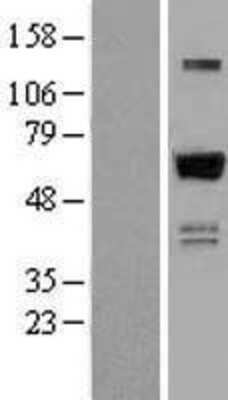 Western Blot: ZNF307 Overexpression Lysate [NBL1-18038]