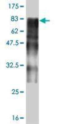 Western Blot: ZNF31 Antibody (3G7) [H00007579-M02]