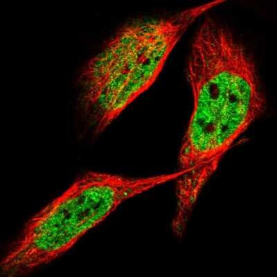 Immunocytochemistry/ Immunofluorescence: ZNF31 Antibody [NBP1-87830]