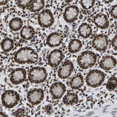 Immunohistochemistry-Paraffin: ZNF31 Antibody [NBP1-87830]