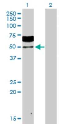 Western Blot: ZNF31 Antibody [H00007579-D01P]