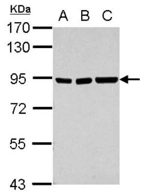 Western Blot: ZNF31 Antibody [NBP2-20988]