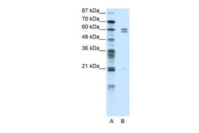 Western Blot: ZNF312 Antibody [NBP2-84355]