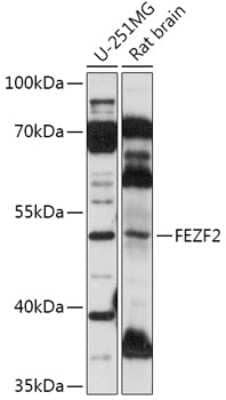 Western Blot: ZNF312 AntibodyAzide and BSA Free [NBP2-94378]