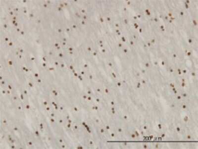 Immunohistochemistry-Paraffin: ZNF313 Antibody (4G3-1A10) [H00055905-M01]