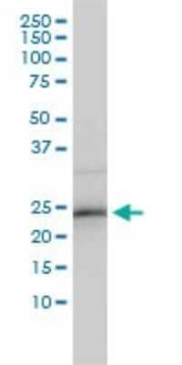 Western Blot: ZNF313 Antibody (4G3-1A10) [H00055905-M01]