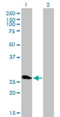 Western Blot: ZNF313 Antibody (4G3-1A10) [H00055905-M01]
