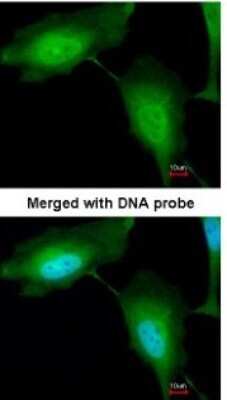 Immunocytochemistry/ Immunofluorescence: ZNF313 Antibody [NBP1-32661]
