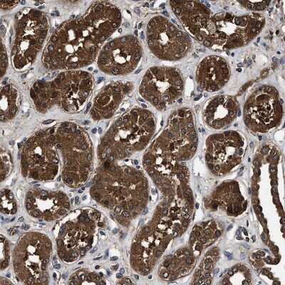 Immunohistochemistry-Paraffin: ZNF313 Antibody [NBP1-87204]