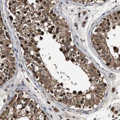 Immunohistochemistry-Paraffin: ZNF313 Antibody [NBP1-87204]